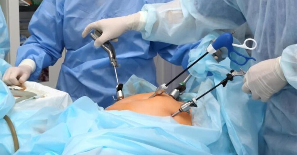 laparoscopy surgery in indore, best laparoscopy surgery in indore